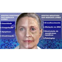 Free Radicals its Effects Antioxidants, Anti-Aging
